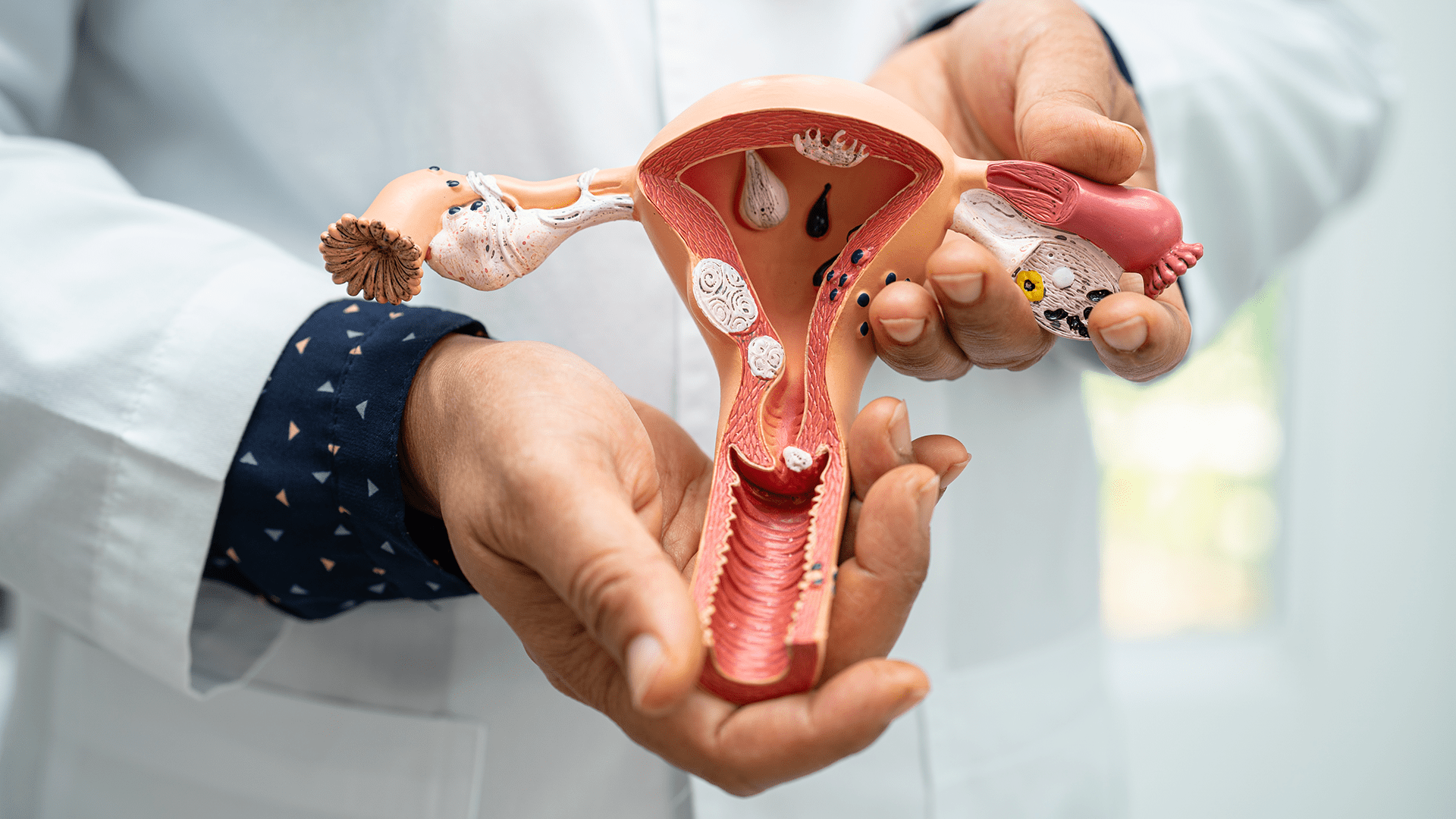 Indian data on response of positive pelvic lymph nodes in carcinoma ...